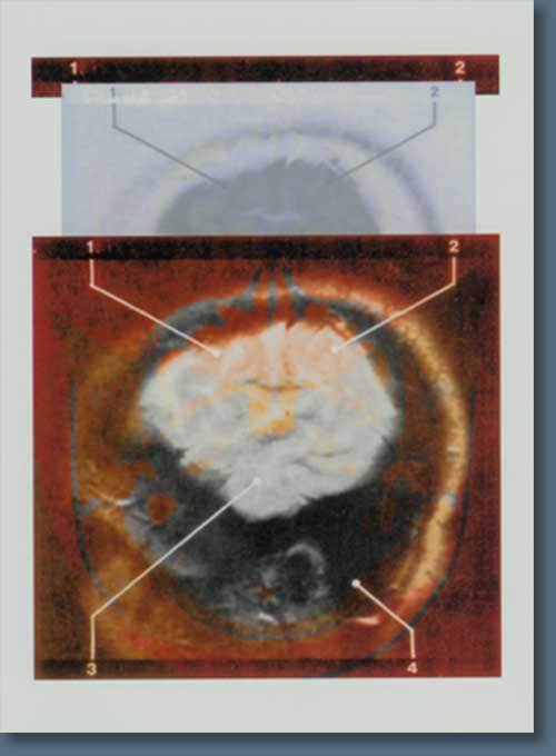 design for main menu page of Jan Peacock dvd